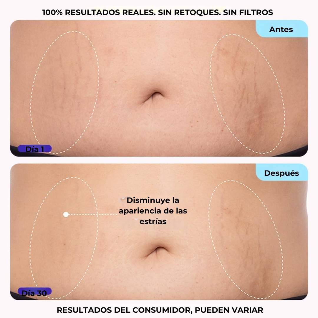 Crema Reafirmante para Vientre y Cuerpo®