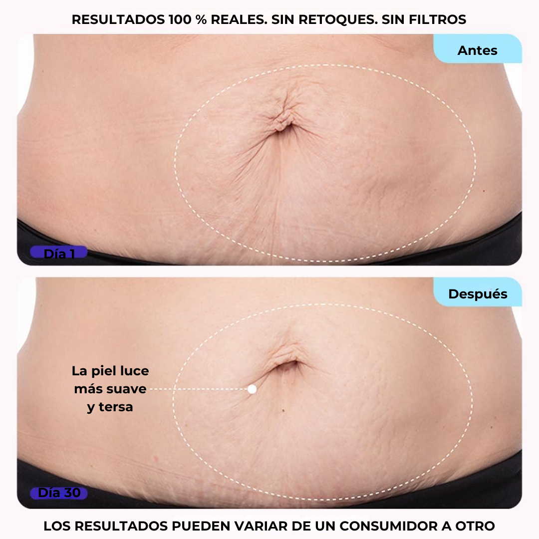 Crema Reafirmante para Vientre y Cuerpo®