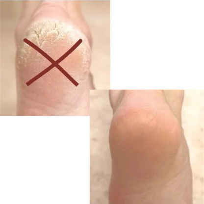 Sistema de Pedicura Automático