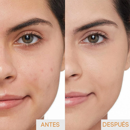 Serum Facial Revitalizante de Vitaminas C y E - 60ml (OFERTA 2X1)®