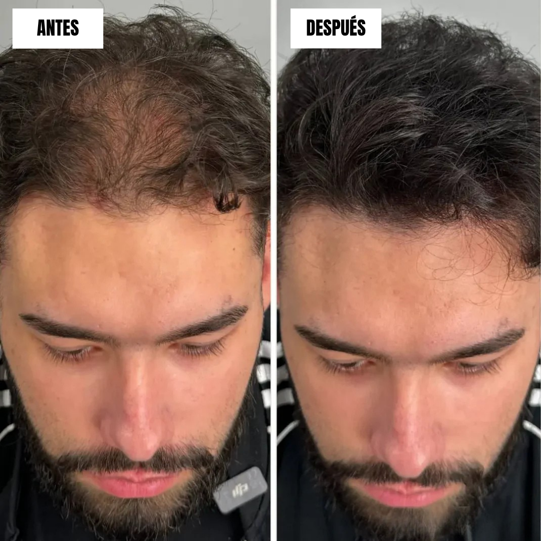 Crema capilar para el Crecimiento instantáneo (OFERTA 2X1)®