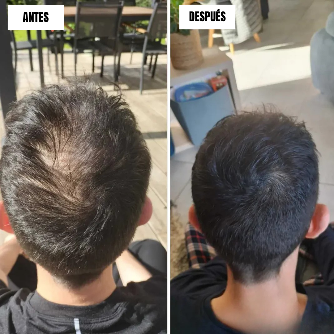 Crema capilar para el Crecimiento instantáneo (OFERTA 2X1)®